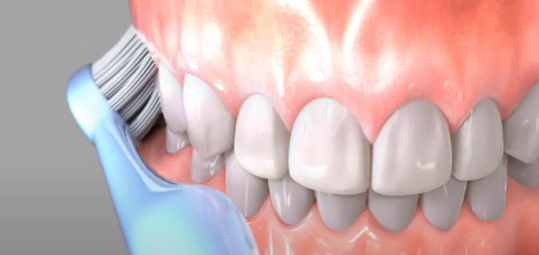 Как подавить рвотный рефлекс во время лечения зубов - ООО «Центр Стоматологии 32 Практика»
