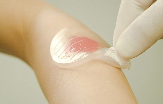 Источник: https://immunocap.ru | В медицине гидрогелевые повязки уже сейчас активно используются для лучшего заживления ран (пролежни, ожоги, трофические язвы)