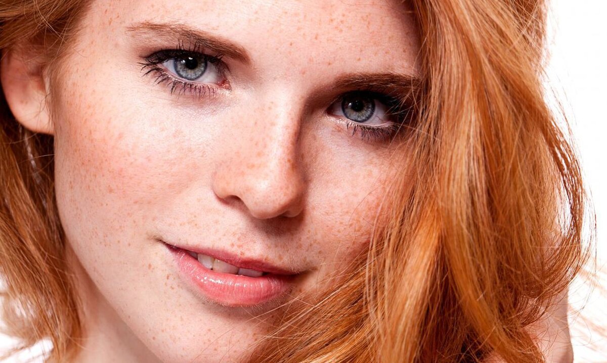 She has freckles. Веснушки эфелиды. Веснушки на лице. Девушка с веснушками. Девушки с веснушками на лице.