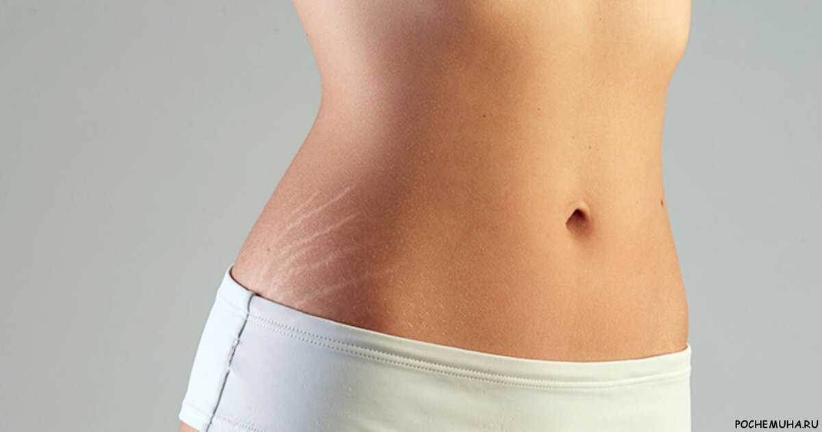 Источник: http://pochemuha.ru