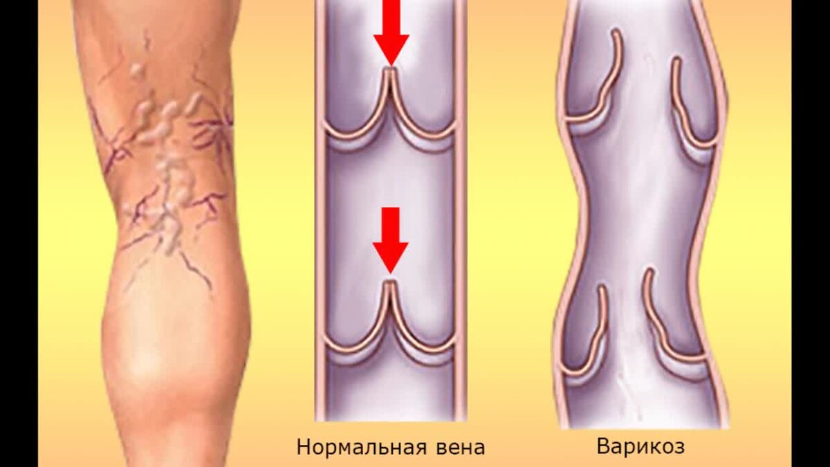 Изображение с сайта budetezdorovy.ru