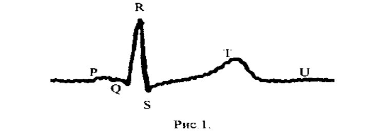 Схема нормальной ЭКГ