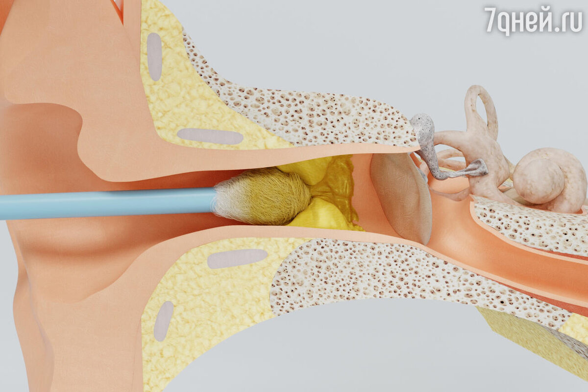   К чему снится ушная сера 123RF/legion-media.ru