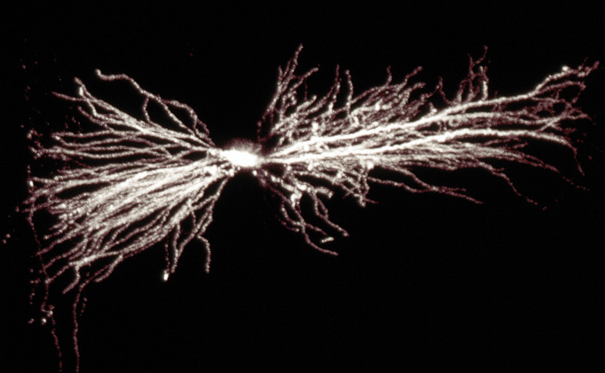 Гинекопамный интернейрон. Изображение: Biosciences Imaging Gp, Soton, Wellcome Trust через Creative Commons
