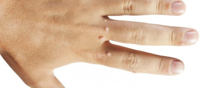 Иллюстрация к статье из Яндекс картинок