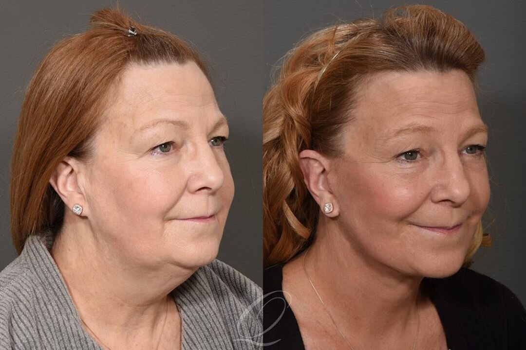 фото: @quatela_center