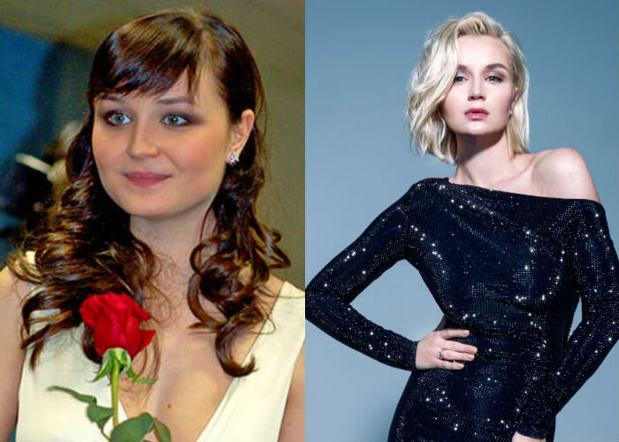 Полина гагарина до похудения и после пластики