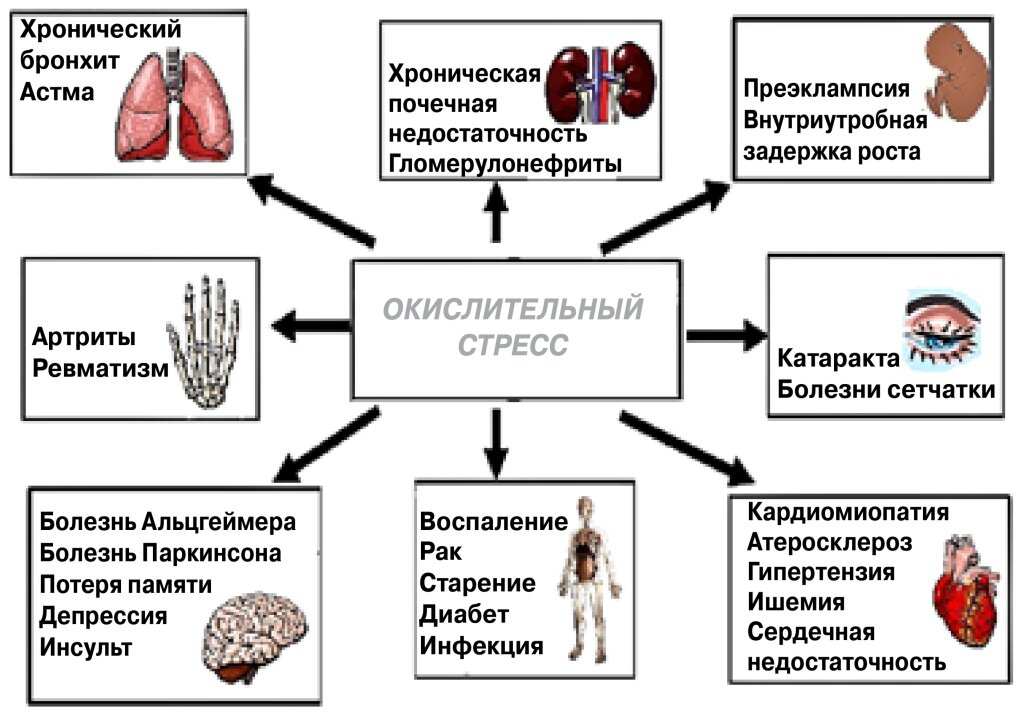 1. Согласно каноническим представлениям, окислительный стресс может поразить любую ткань, вызывая многочисленные болезни