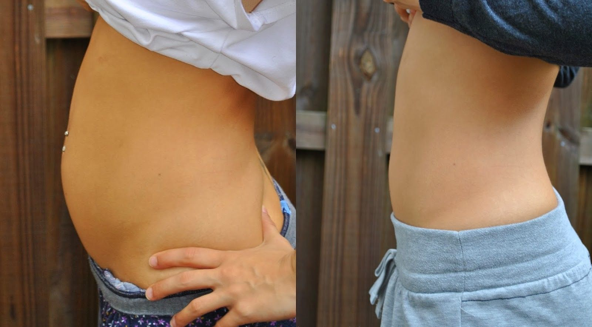 Как оказалось, живот сильно вздулся. А я и не заметила.