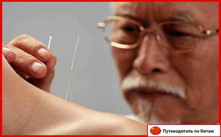 путешествия, путешествия по Китаю, здоровье, алкоголь, лечение в Китае, лечение, иглоукалывание