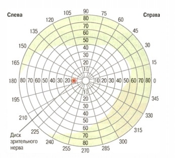 Периметрическая карта, демонстрирующая поле зрения для левого глаза.