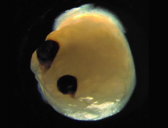 мини-мозг в стиле Кроненберга