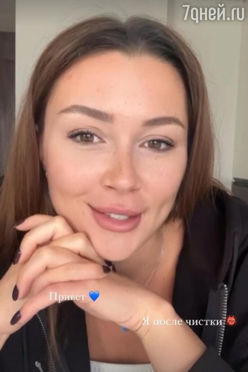    Анна Заворотнюк Социальные сети