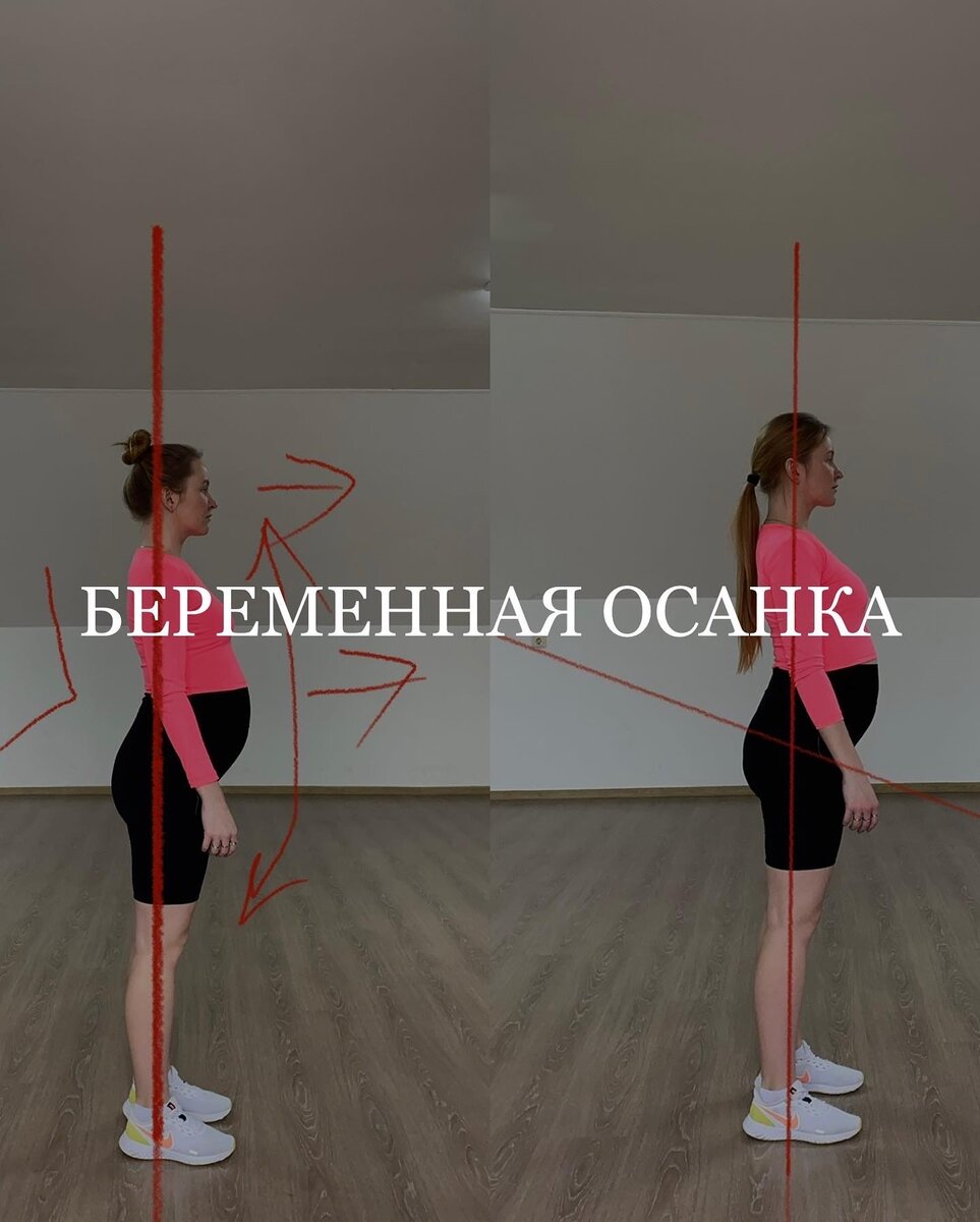 Как меняется осанка в беременность? Показываю наглядно на своём теле |  TRENER MARIYA | Дзен