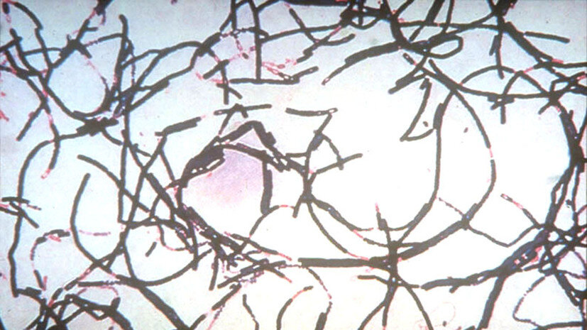     Бактерии сибирской язвы под микроскопом Gettyimages.ru U.S. Army Medical Research and Development