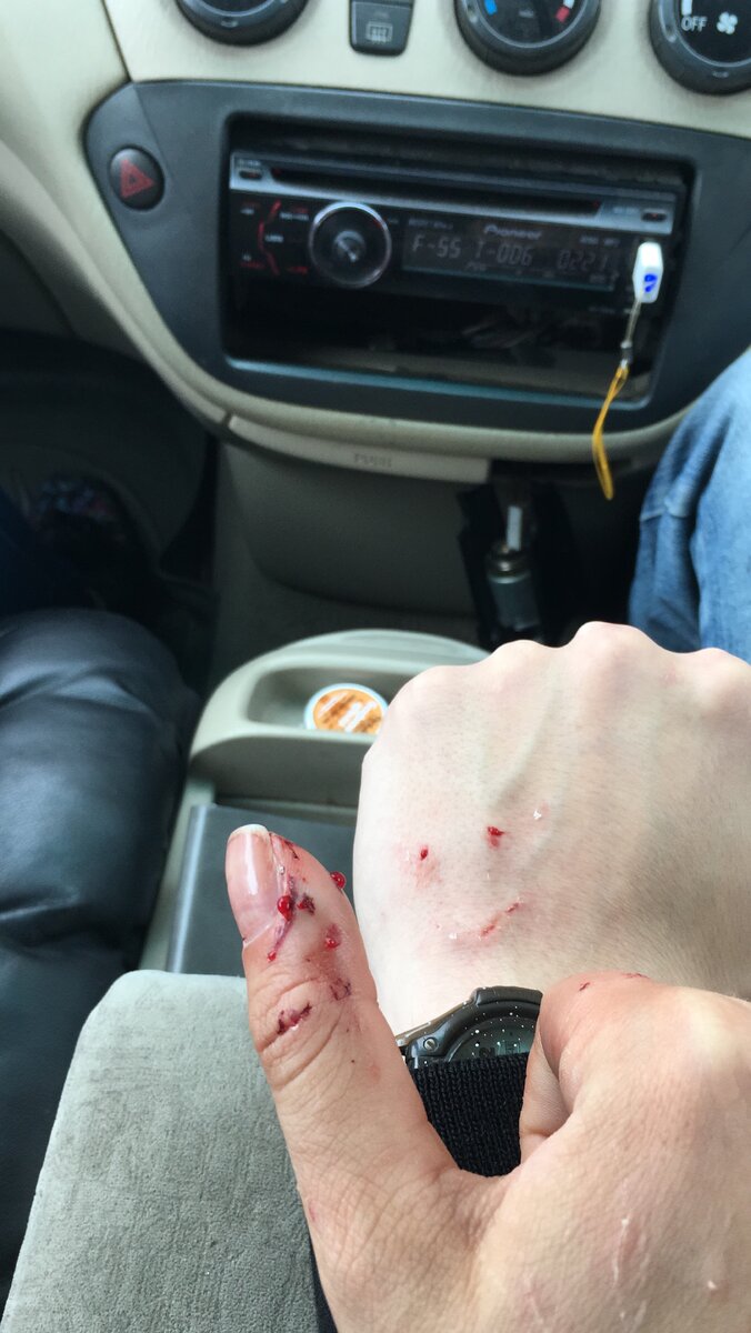 Фото моей руки, и руки друга. Я не помню как он получил ранение, но, возможно, он расскажет сам об этом в комментариях, если сам вспомнит.)))