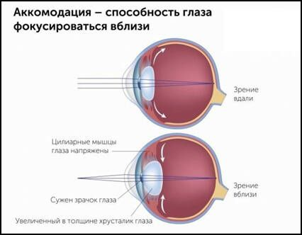 Аккомодация - способность глаза фокусироваться вблизи