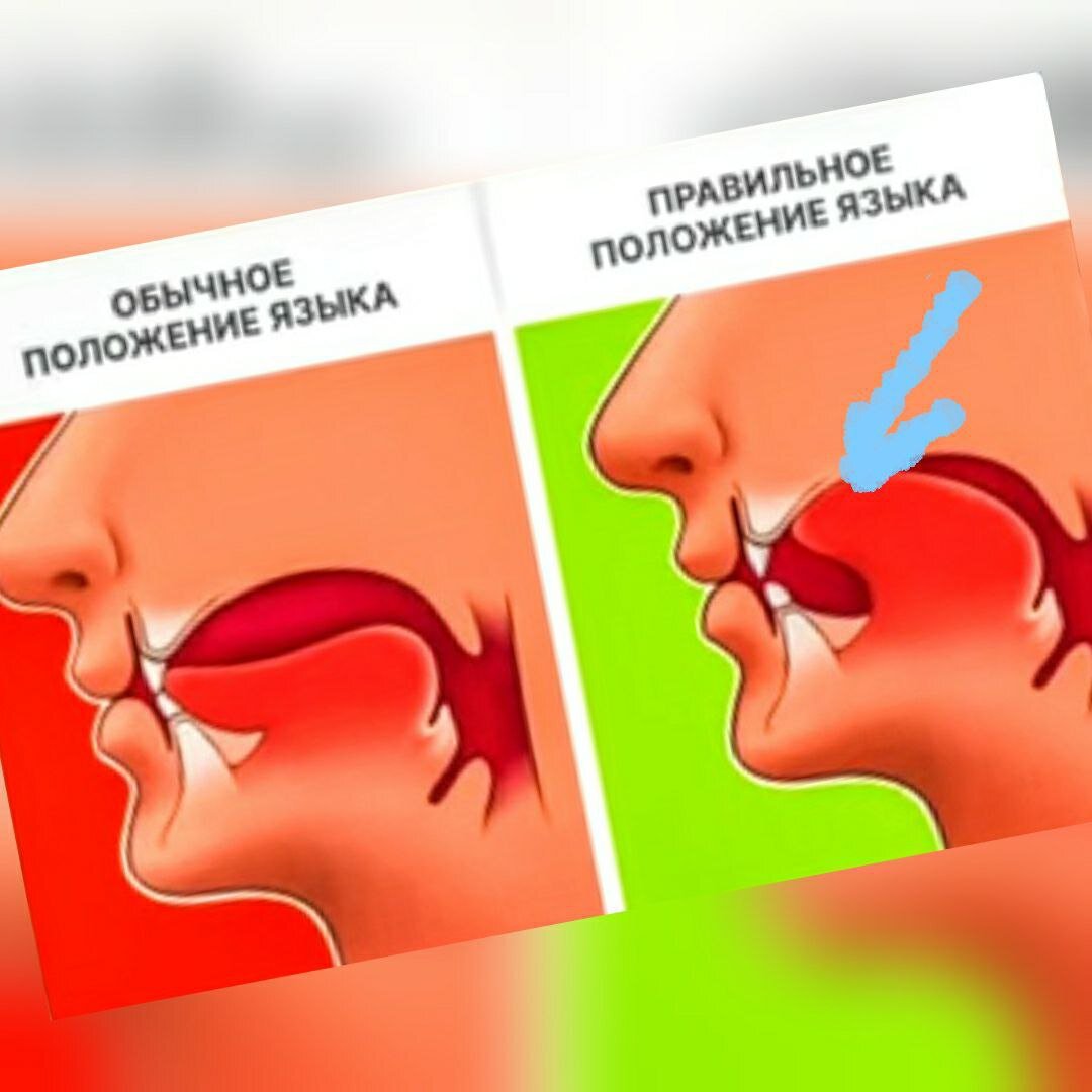 Правильно справа.