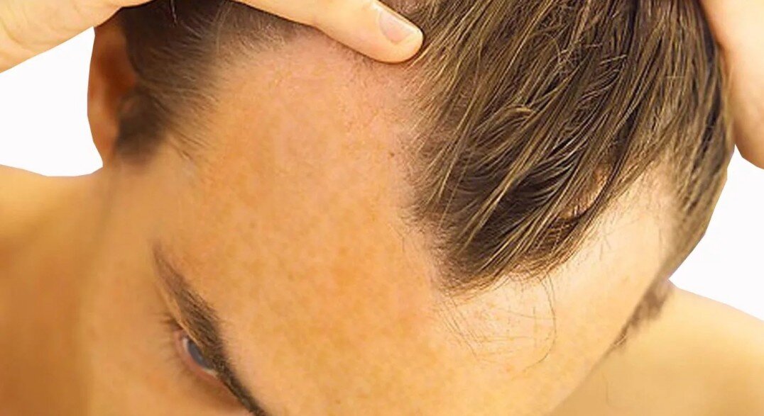 Фото взято из открытых источников Яндекс поиска.