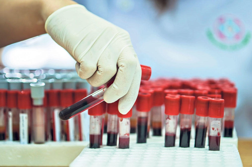 Пробирки с кровью. Лабораторные исследования крови. Пробы крови. Материалы для лабораторных исследований.