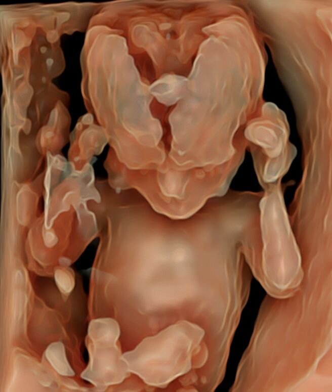 В иллюстративных целях