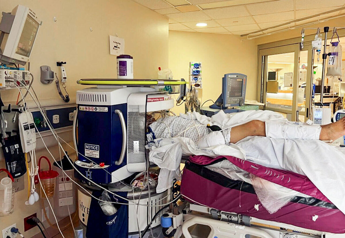 МРТ сканер с низким разрешением снимает пациента на кровати в отделении интенсивной терапии Йельской больницы Нью-Хейвен