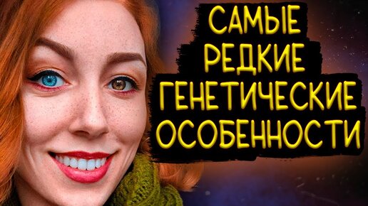 САМЫЕ РЕДКИЕ ГЕНЕТИЧЕСКИЕ ОСОБЕННОСТИ