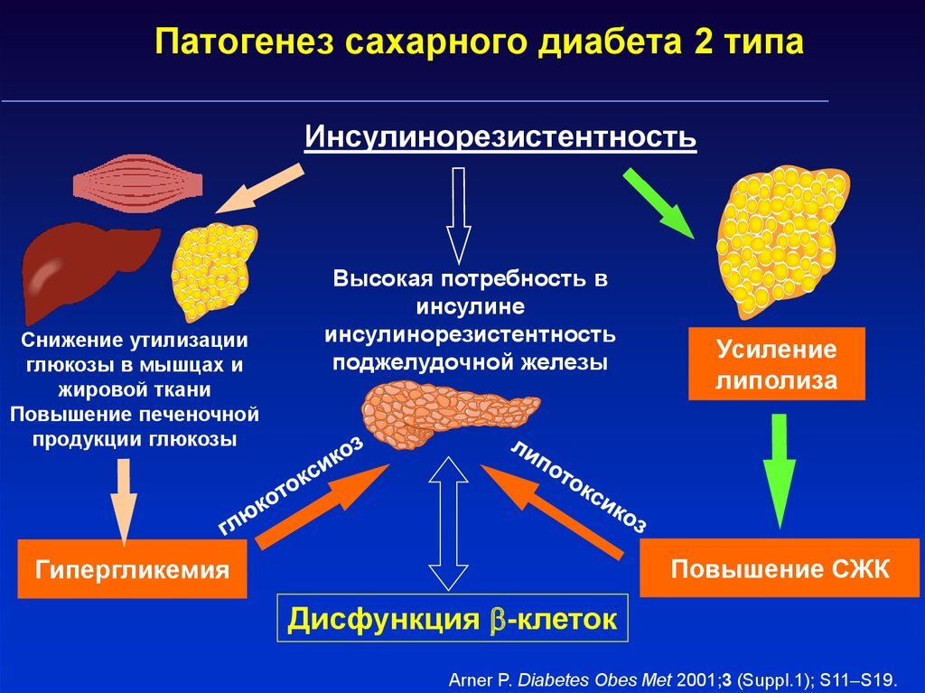 Диабет 2 типа презентация