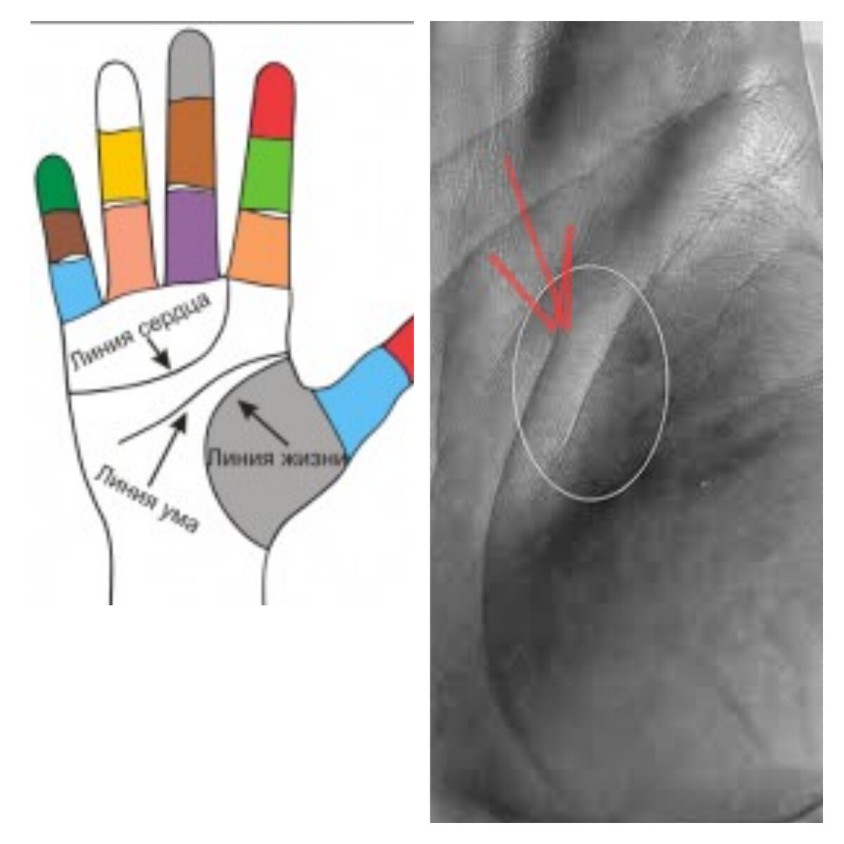 Разрыв на линии Жизни