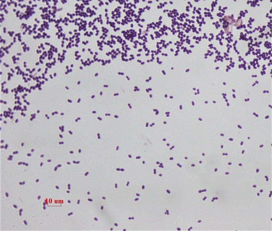 Фирмикуты под микроскопом (Enterococcus faecium).