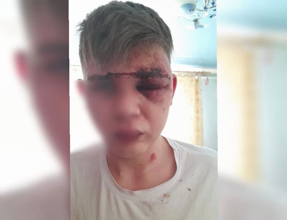    Не приняли заявление в полиции: Депутат горсовета Оренбурга рассказал подробности избиения подростка в школе Илека