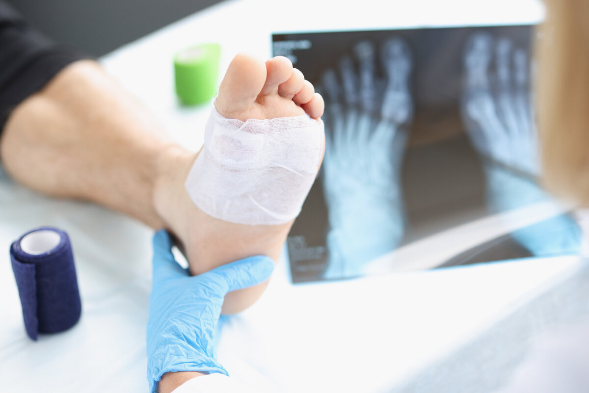 реабилитация после перелома. травматология и ортопедия. моники операция травматология. травматолог что лечит. травматология.