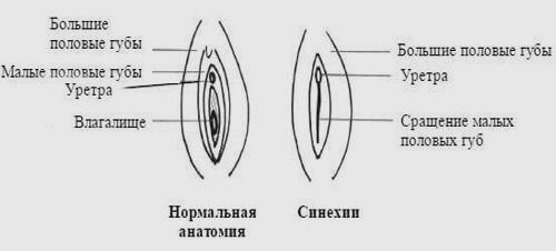 Чёрные половые губы