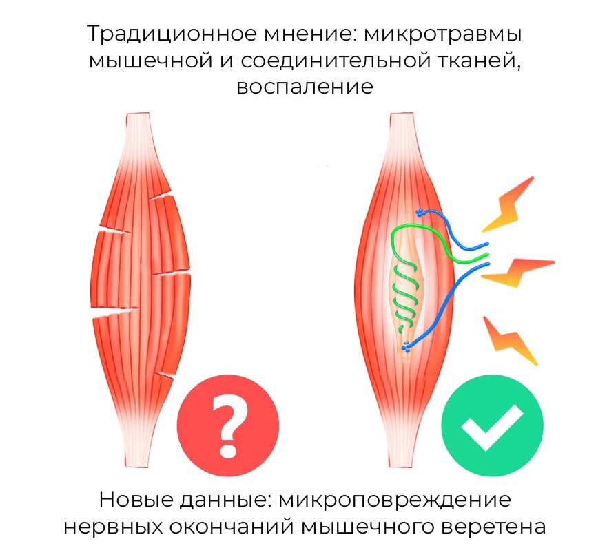 Отчего болят мышцы на самом деле? | Дмитрий Калашников | Дзен