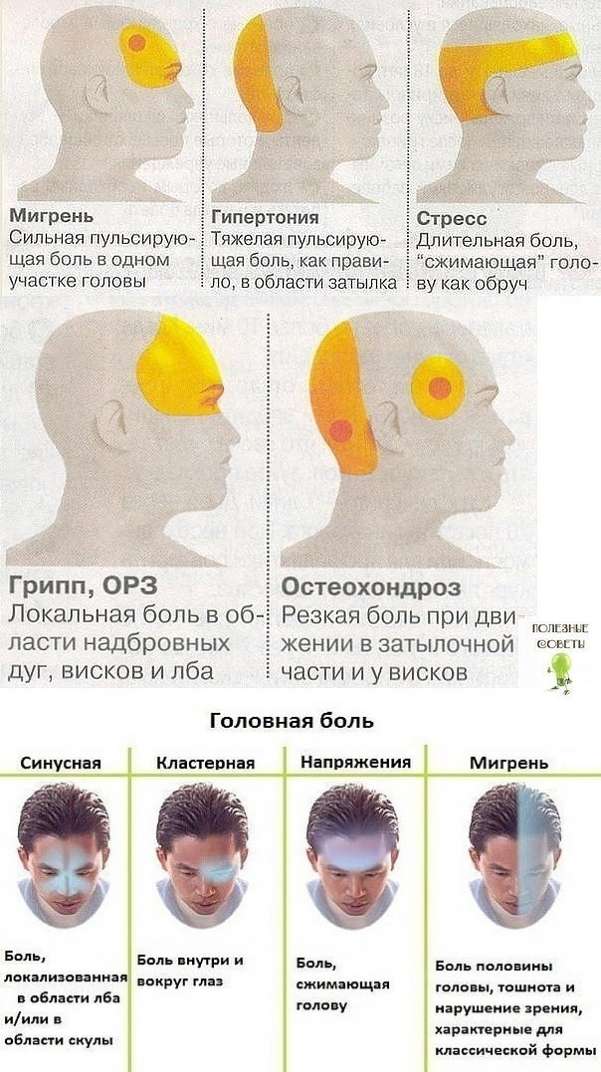 Почему в голове тепло. Головная боль висок и лоб правая сторона.