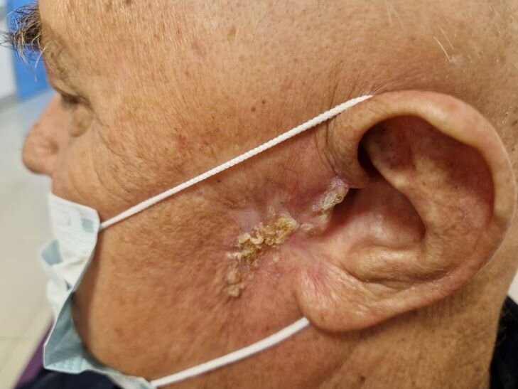    Фото - Центр Мешалкина