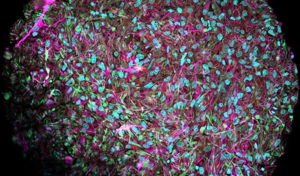 Канал - ФУТУРИЗМ - Ученые прогнозируют, что органоидный мозг из пробирки превзойдет компьютерный ИИ благодаря интуиции. 
