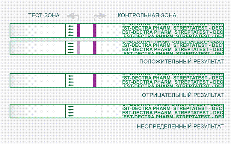 Так выглядит результат "Стрептатеста"