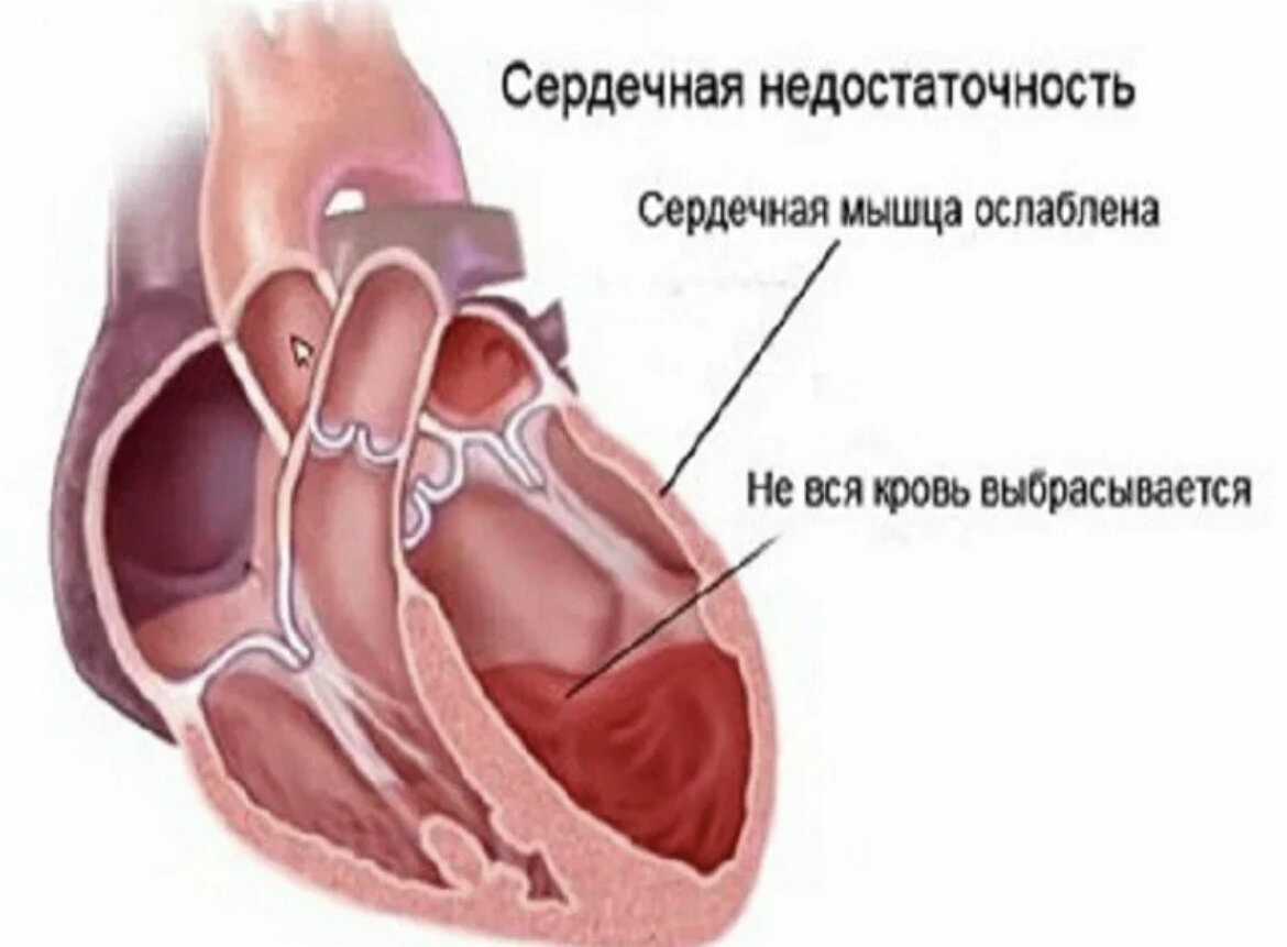 Нервная и гуморальная регуляция сердечной деятельности. Сердечная недостаточность. Работа сердца. Симптомы острой сердечной недостаточности. Нервная и гуморальная регуляция деятельности сердца.