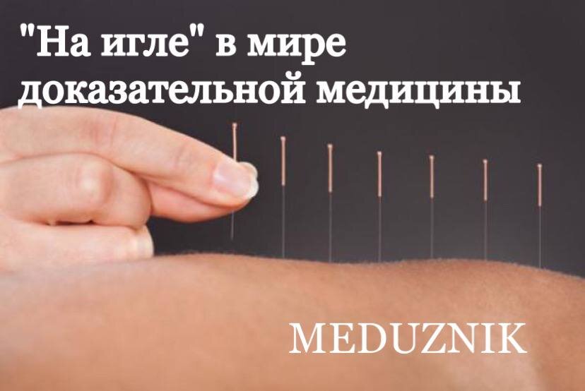 В сегодняшней медицине укрепляются тенденции, основанные на доказательном подходе к здоровью и болезням человека. Но Восточная медицина, используемая с древнейших времен, и сегодня не утрачивает своей актуальности. Одним из методов лечения, насчитывающим более чем двухтысячелетнюю историю, стала акупунктура, которая, как считается, воздействует через нервную систему на все органы и системы человека. В данной статье мы попробуем разобраться, так ли это на самом деле.