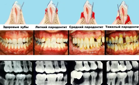 взято из общего доступа