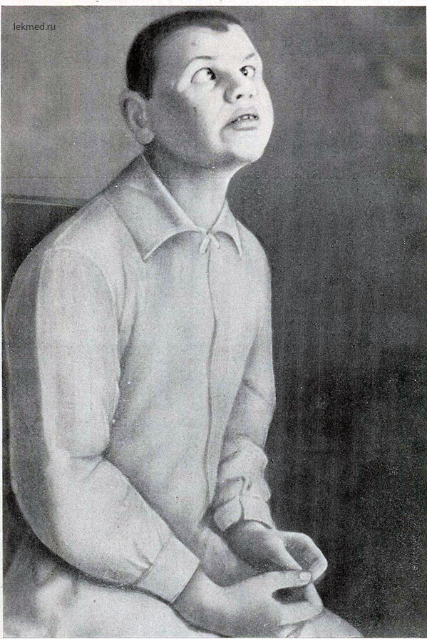 дебильность имбецильность идиотия. вы идиот. капуста в медицинской шапочке. надпись идиот. глубокая форма умственной отсталости.