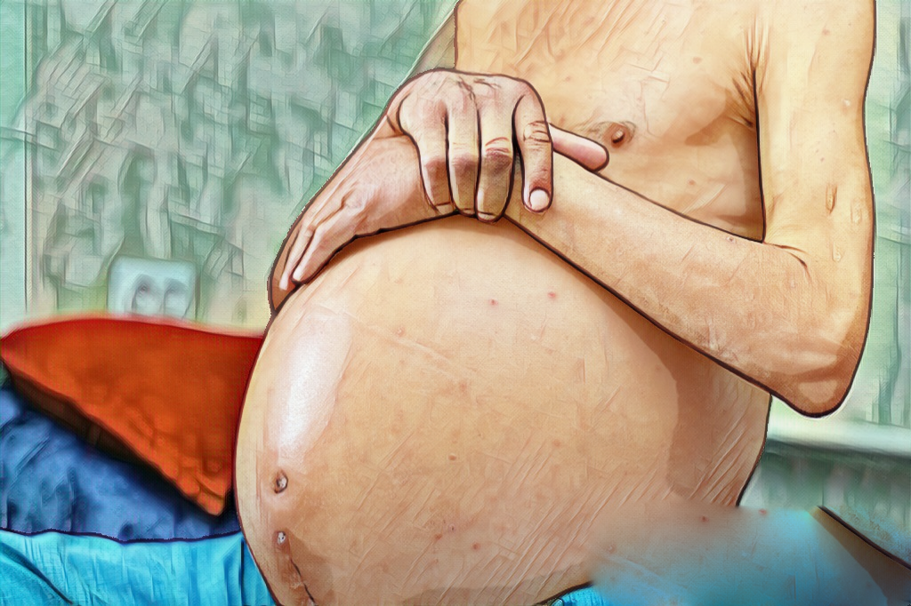 Алкоголь убивает. Фото из открытых источников интернет