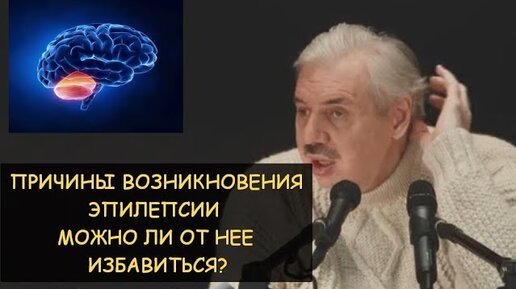 Николай Левашов. Эпилепсия - причины возникновения и можно ли от нее ...