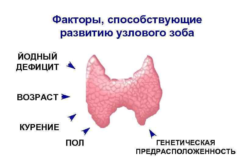 Многоузловой зоб лечение. Этиология зоба щитовидной железы. Факторы способствующие развитию заболеваний щитовидной железы. Многоузловой зоб этиология. Узловой зоб этиология.