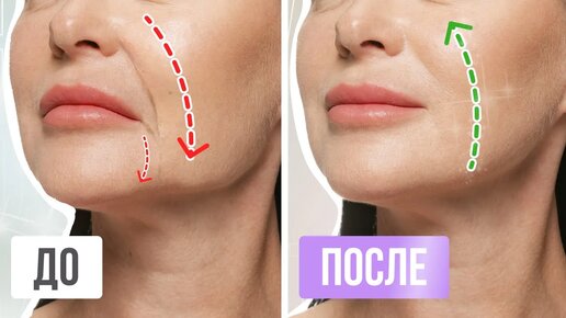 Как убрать морщины на лице: самые эффективные методы
