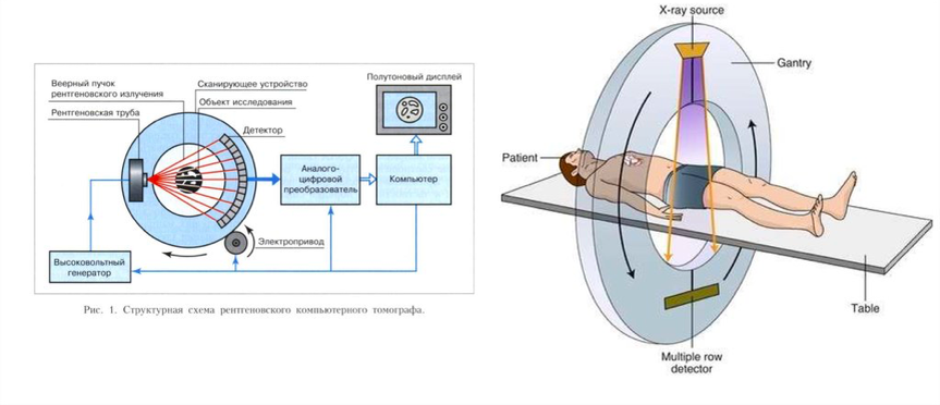 Устройство КТ и принцип его работы