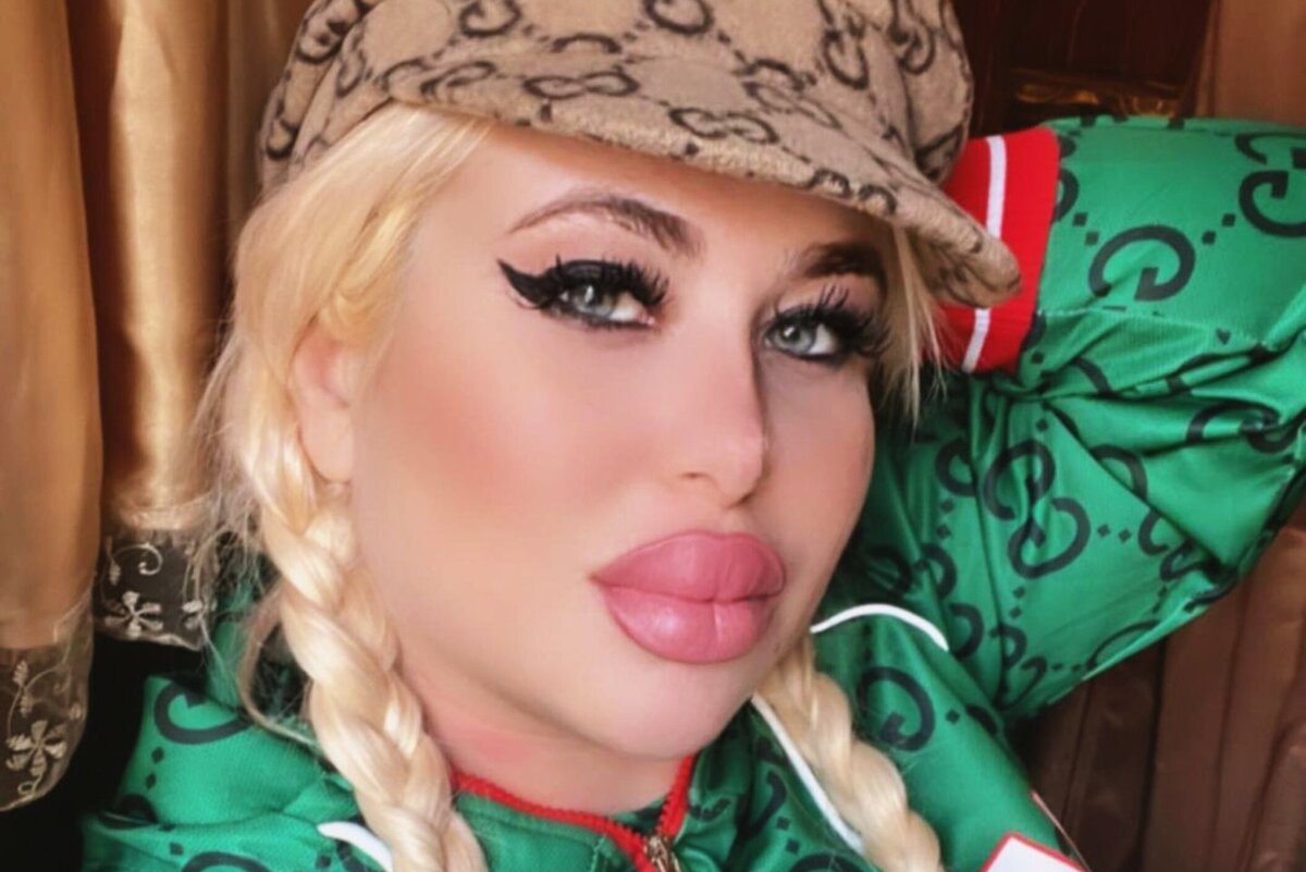     Зеркало упало на голову: звезда шансона Алена Андерс в тяжелом состоянии попала в реанимацию