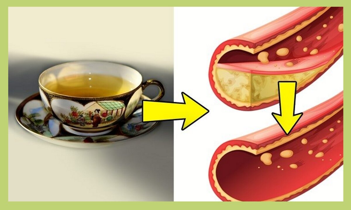 Чай при повышенном холестерине