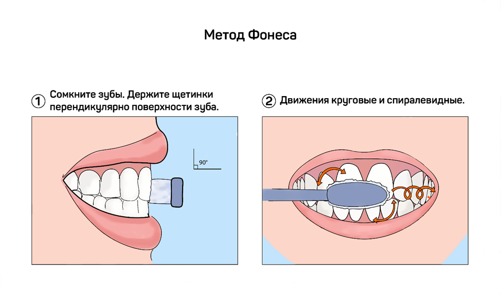 Типы щеток